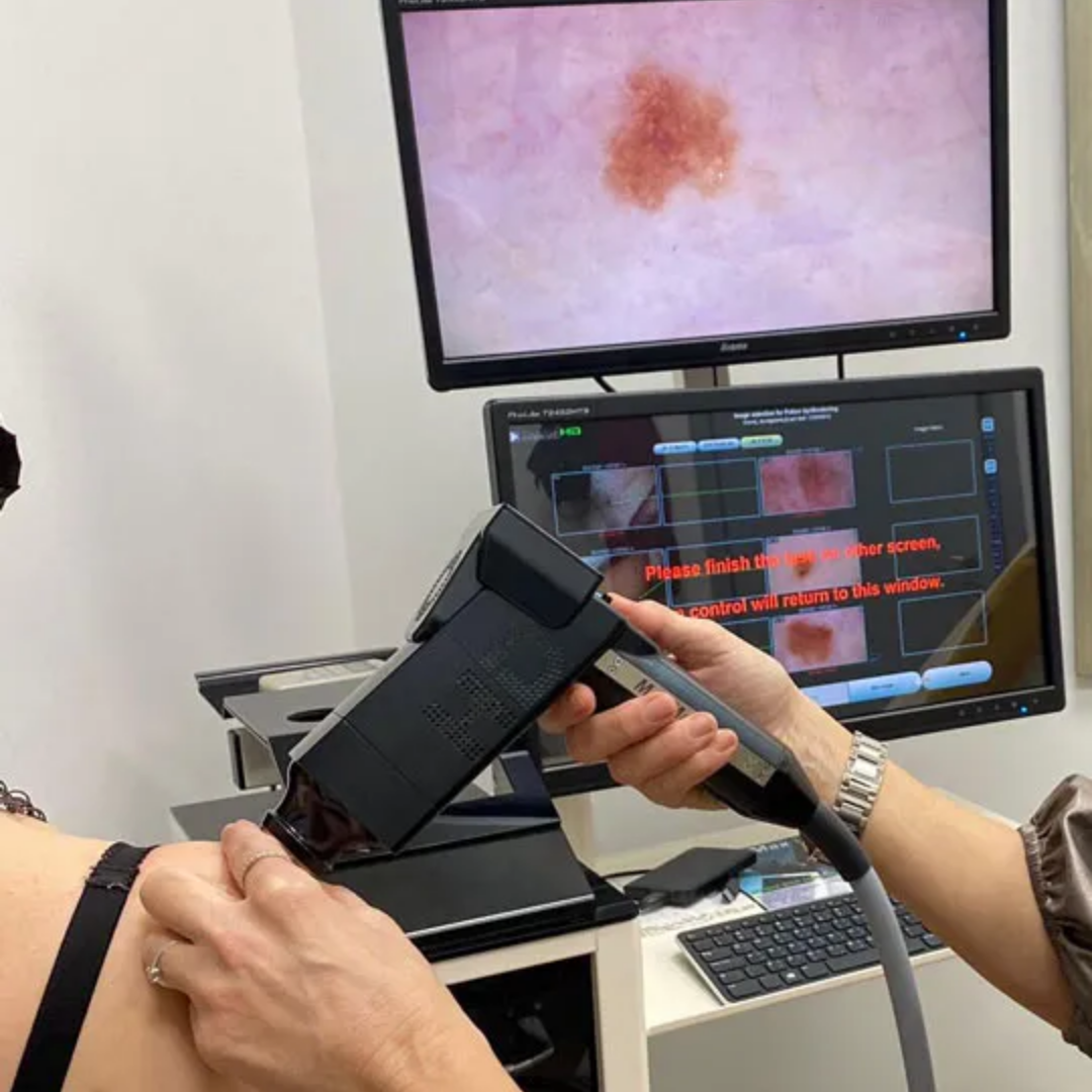 What to Expect at a Dermatology Consultation at The Adare Clinic