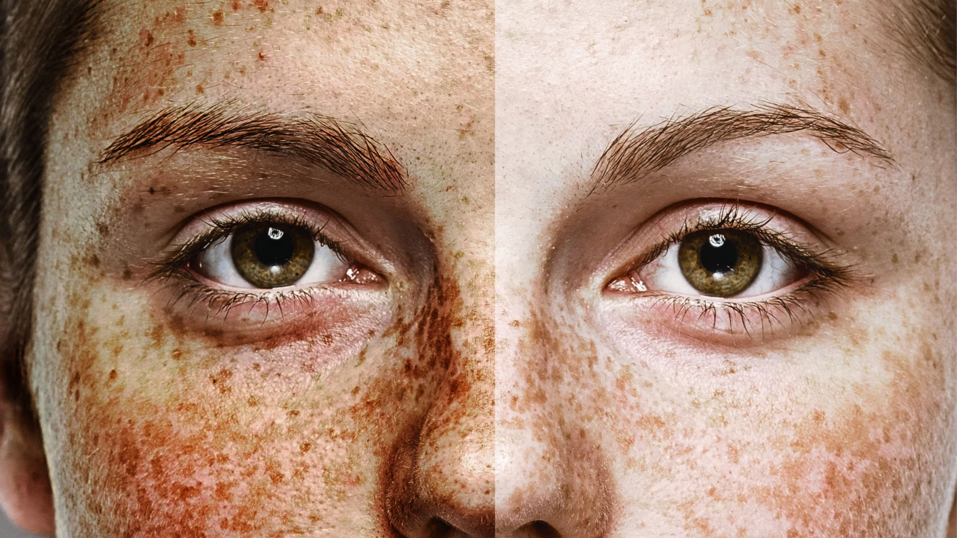 The Hidden Cost of Sun Exposure | By Dr Naomi Mackle