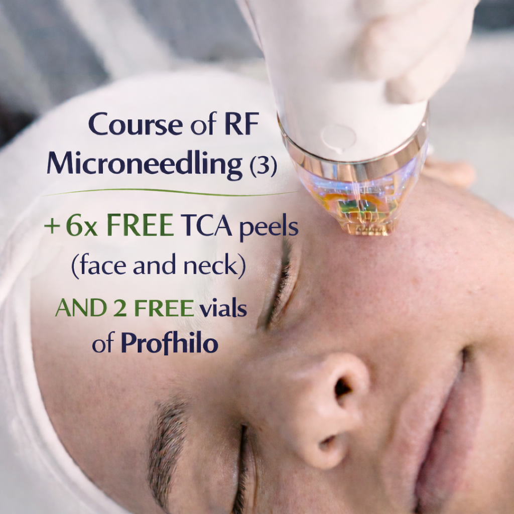 Mother’s Day Special: RF Microneedling Course + Complimentary Profhilo